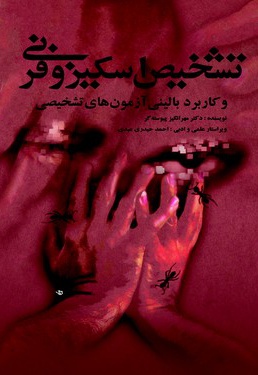 تشخیص اسکیزوفرنی